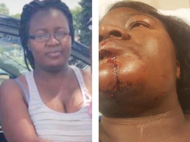 Kenyan Woman in Minnesota Nursing Serious Injuries after Attack by Husband at a Petrol Station