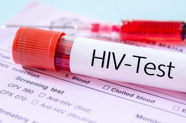 More Than 4,000 Homosexuals in Kilifi Infected with HIV, Official Says