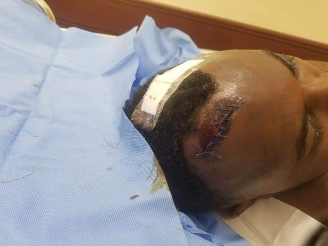 Senator Anwar Loitiptip Admitted to ICU After Attack by Armed Men at a Nairobi Club