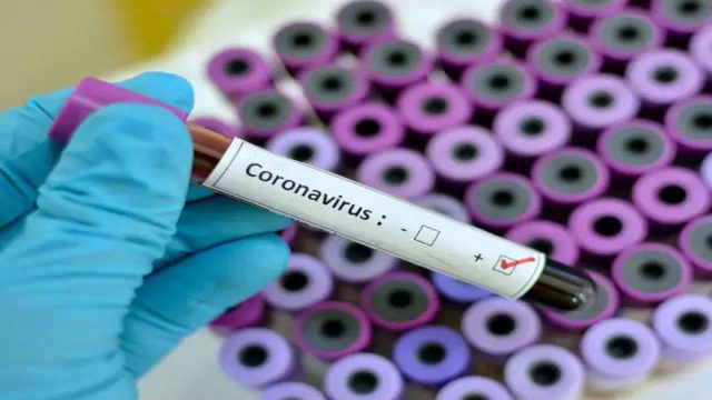 Kenya’s Coronavirus Cases Rise to 126