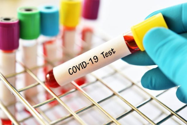 Confusion as Kenyan Who Tested Positive for Covid-19 in Uganda Gets Negative Result in Kenya