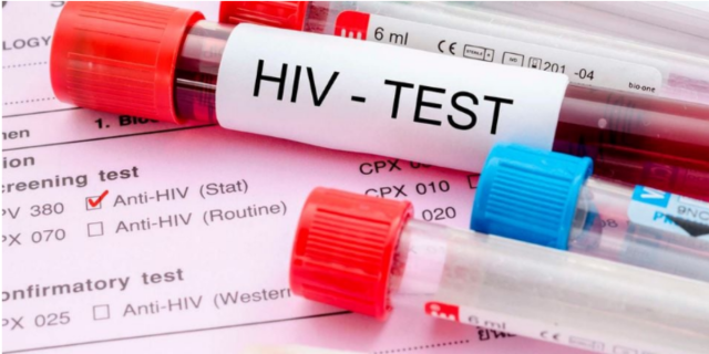 Concern as Nine Kenyan Counties Record Surge in HIV Cases